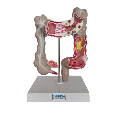 MODÈLE INTESTINE/COLON
